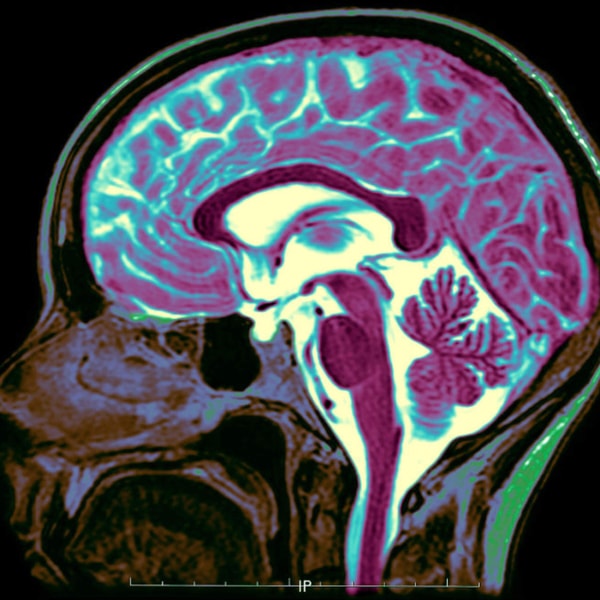 Brainwaves: Why is the brain such a mystery?